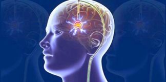 Deep Brain Stimulation Devices market