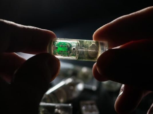 ingestible sensors market