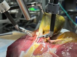 1st Realistic Surgery